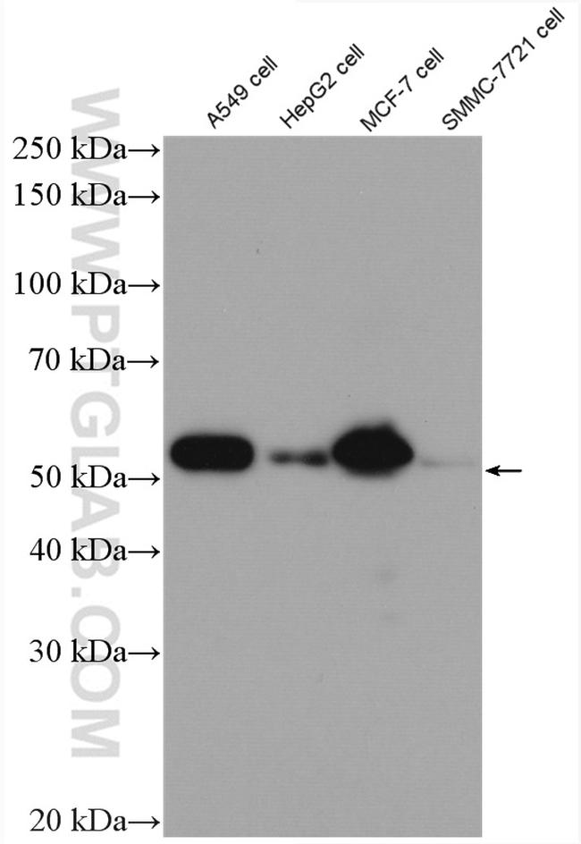 P53 Antibody in Western Blot (WB)