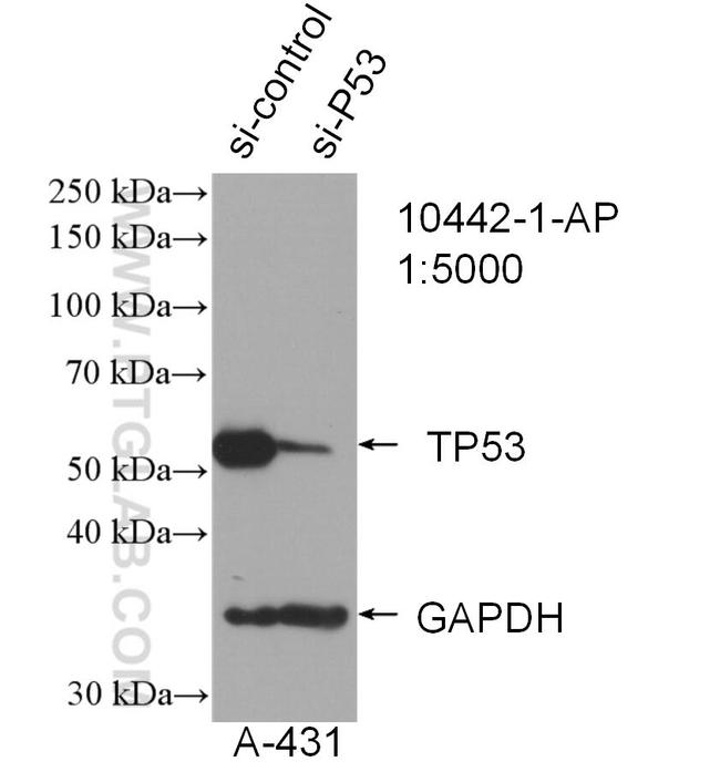 P53 Antibody in Western Blot (WB)