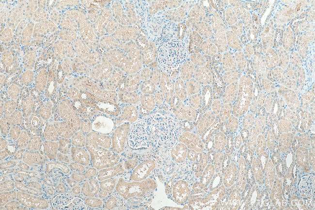 SLC43A1 Antibody in Immunohistochemistry (Paraffin) (IHC (P))