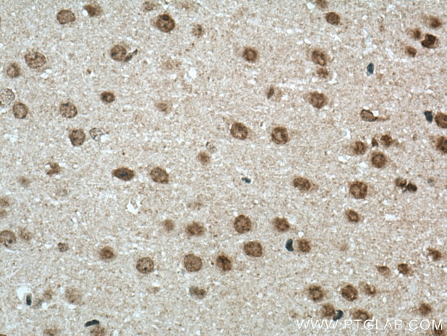 NOP2 Antibody in Immunohistochemistry (Paraffin) (IHC (P))