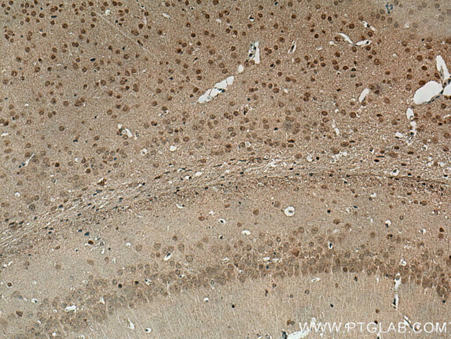 NOP2 Antibody in Immunohistochemistry (Paraffin) (IHC (P))