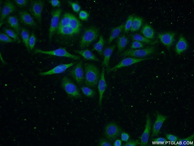 GADD34 Antibody in Immunocytochemistry (ICC/IF)