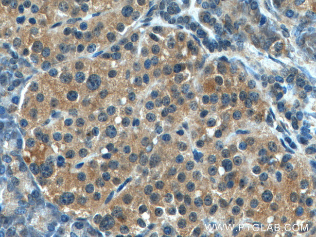 GADD34 Antibody in Immunohistochemistry (Paraffin) (IHC (P))