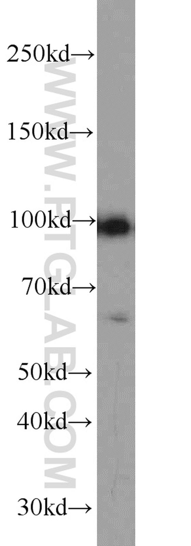 GADD34 Antibody in Western Blot (WB)