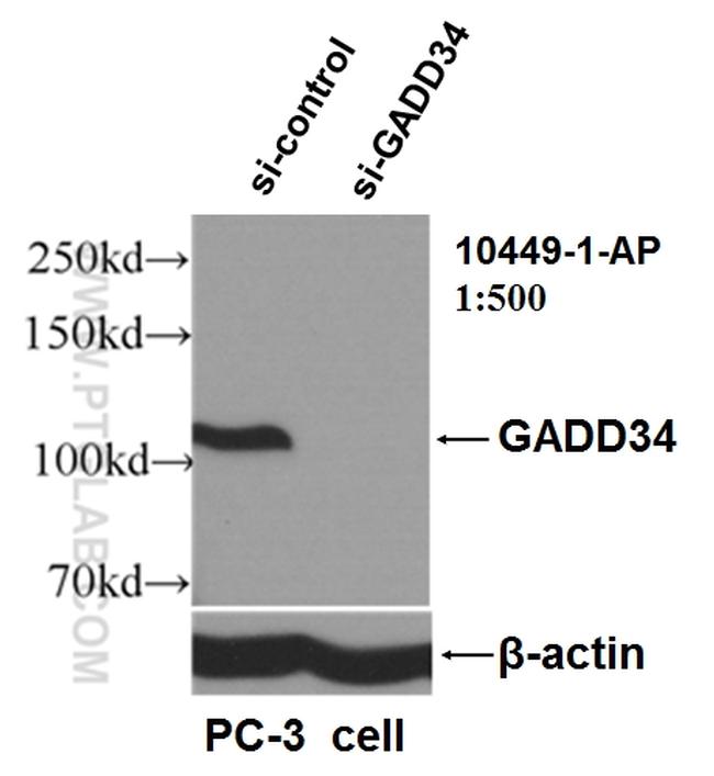 GADD34 Antibody in Western Blot (WB)