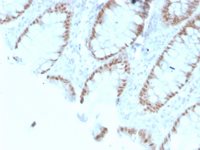 CDX2/Caudal Type Homeobox 2 Antibody in Immunohistochemistry (Paraffin) (IHC (P))