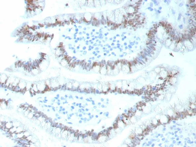 CDX2/Caudal Type Homeobox 2 (GI Epithelial Marker) Antibody in Immunohistochemistry (Paraffin) (IHC (P))