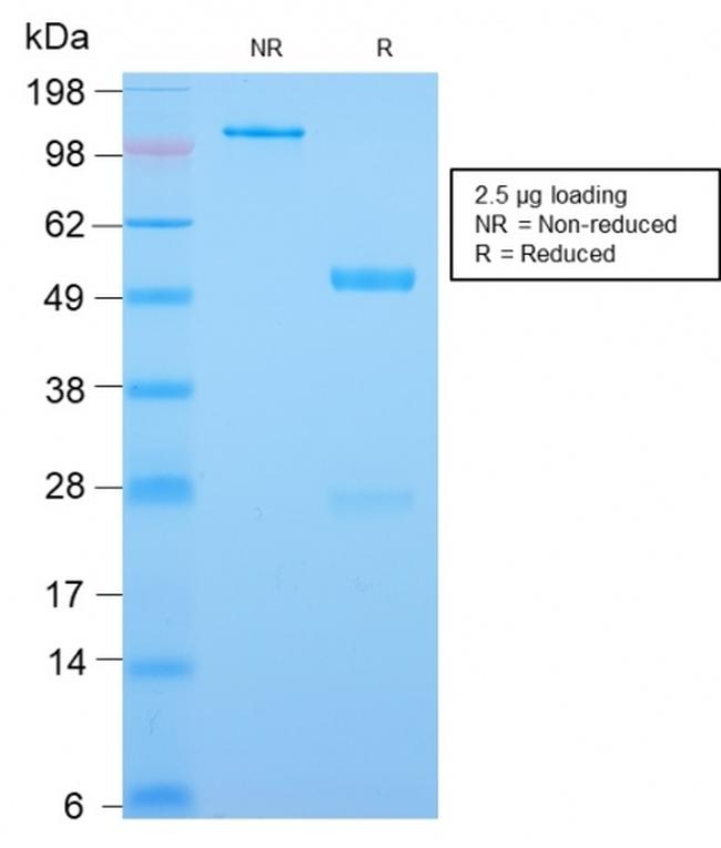 CDX2/Caudal Type Homeobox 2 Antibody in SDS-PAGE (SDS-PAGE)