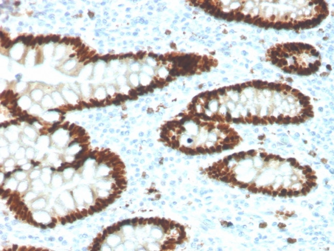 CDX2/Caudal Type Homeobox 2 Antibody in Immunohistochemistry (Paraffin) (IHC (P))