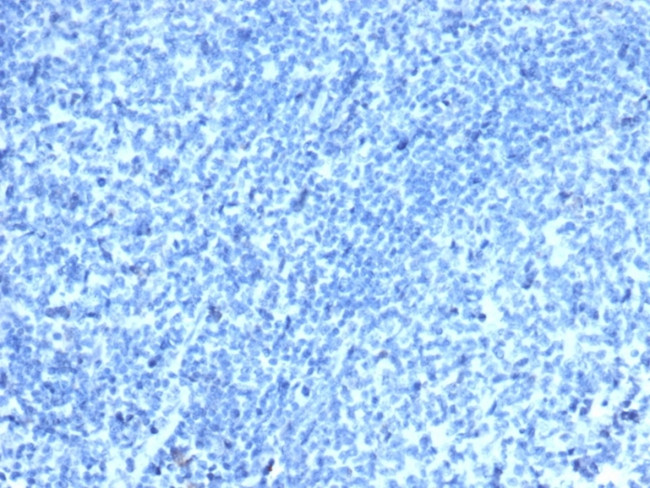 CDX2/Caudal Type Homeobox 2 Antibody in Immunohistochemistry (Paraffin) (IHC (P))