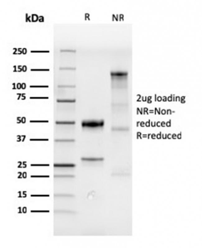 CDX2/Caudal Type Homeobox 2 Antibody in SDS-PAGE (SDS-PAGE)