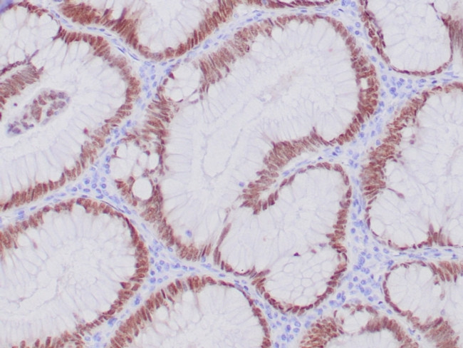 CDX2/Caudal Type Homeobox 2 Antibody in Immunohistochemistry (Paraffin) (IHC (P))