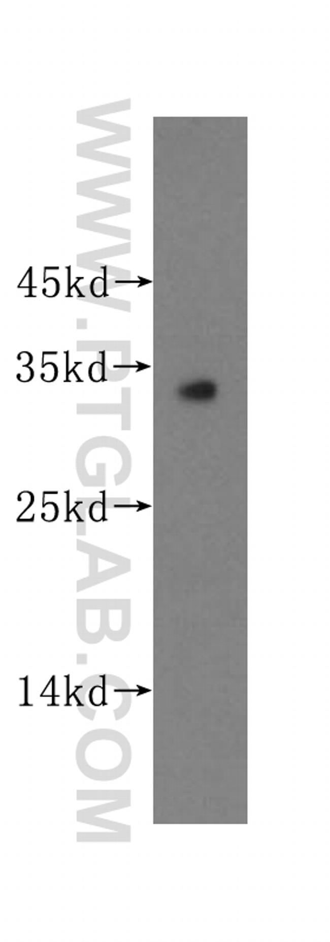 Connexin-32 Antibody in Western Blot (WB)