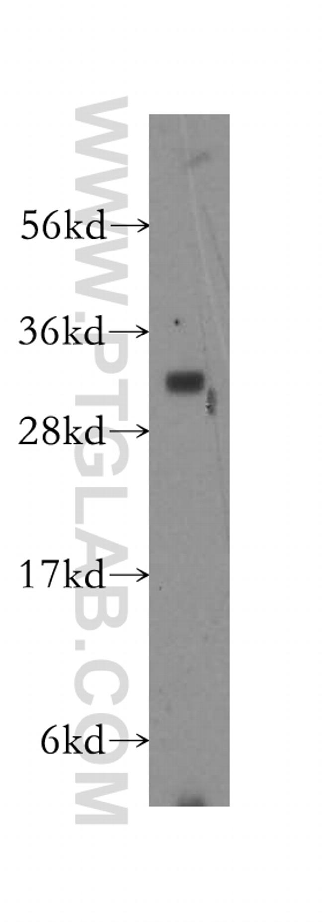 Connexin-32 Antibody in Western Blot (WB)