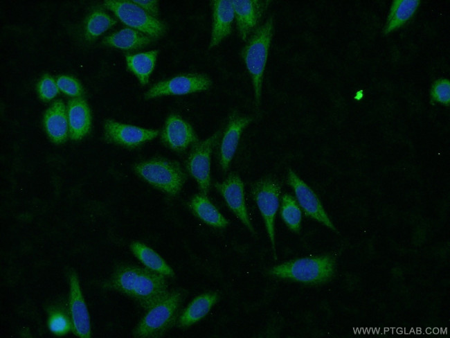 CLTB Antibody in Immunocytochemistry (ICC/IF)