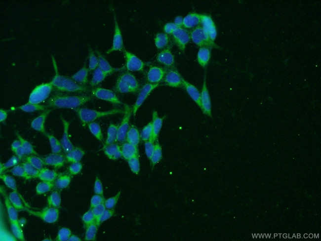 CLTB Antibody in Immunocytochemistry (ICC/IF)