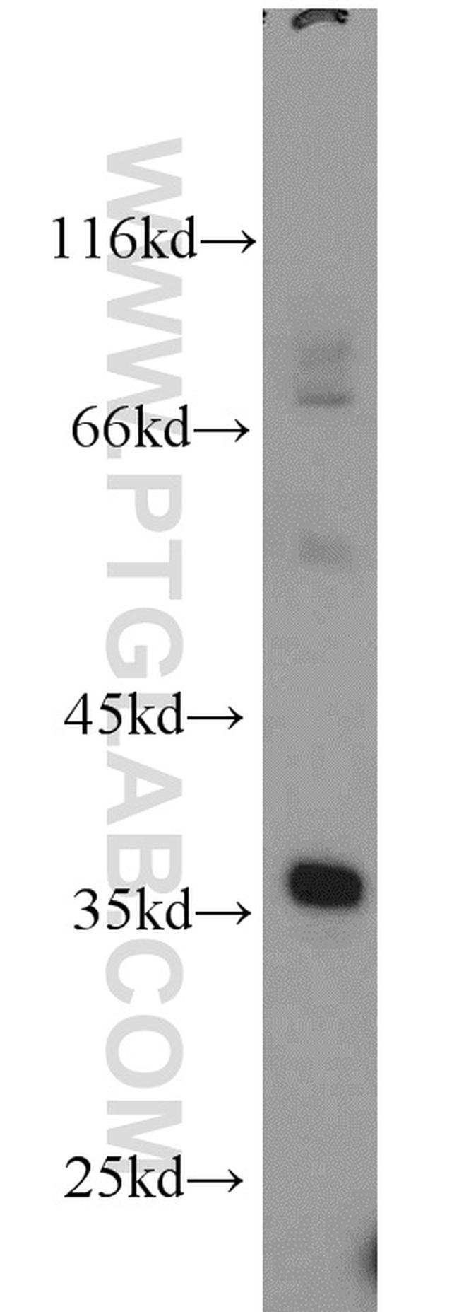 CLTB Antibody in Western Blot (WB)