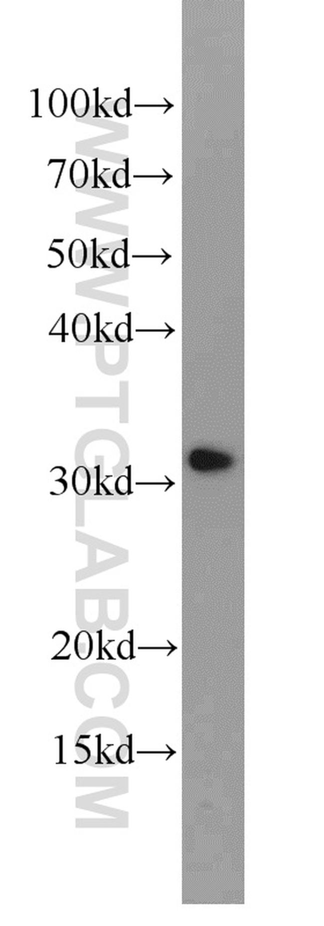 CLTB Antibody in Western Blot (WB)