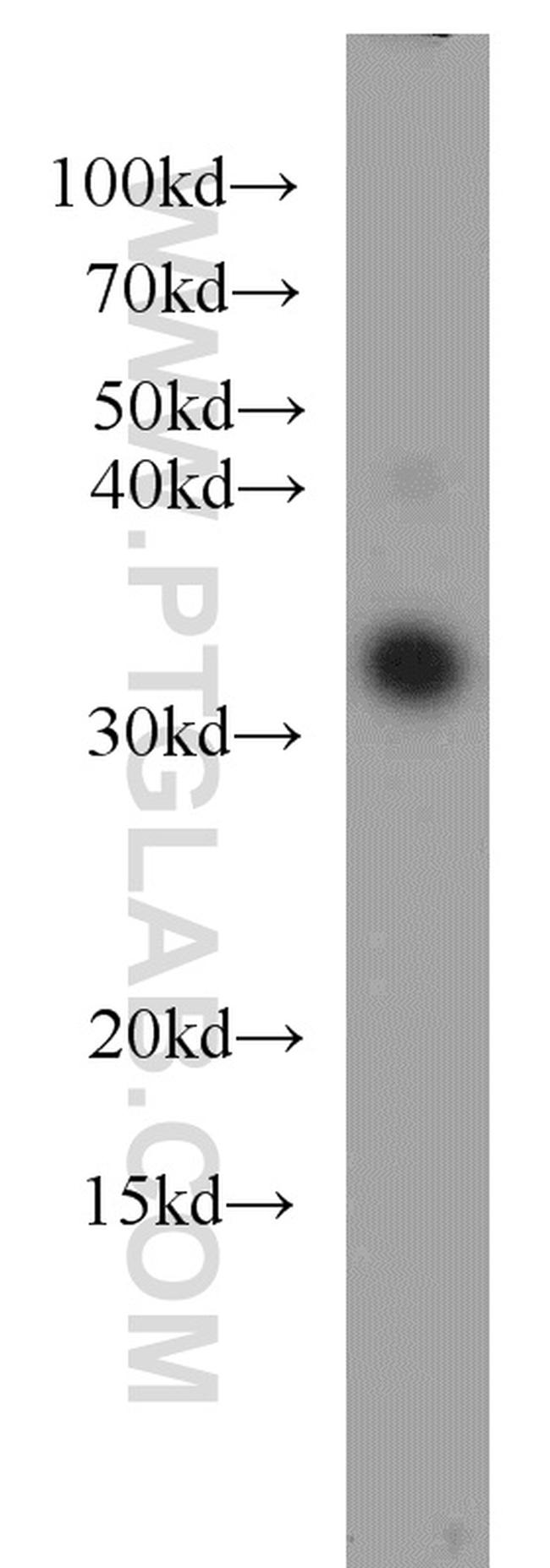 CLTB Antibody in Western Blot (WB)