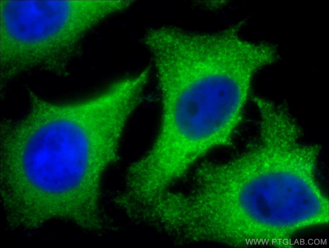 CLTB Antibody in Immunocytochemistry (ICC/IF)