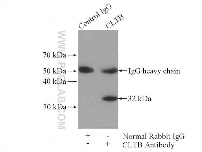 CLTB Antibody in Immunoprecipitation (IP)