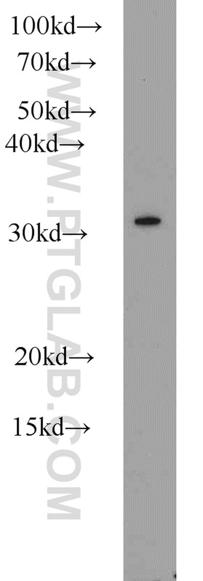 CLTB Antibody in Western Blot (WB)