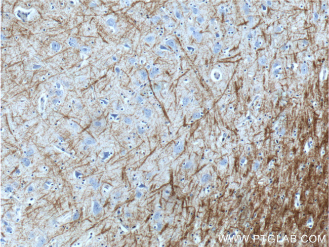 Myelin basic protein Antibody in Immunohistochemistry (Paraffin) (IHC (P))