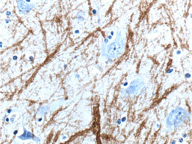 Myelin basic protein Antibody in Immunohistochemistry (Paraffin) (IHC (P))