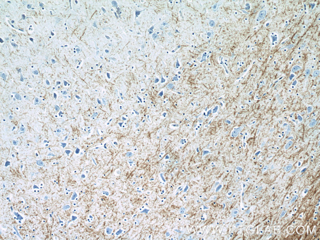 Myelin basic protein Antibody in Immunohistochemistry (Paraffin) (IHC (P))