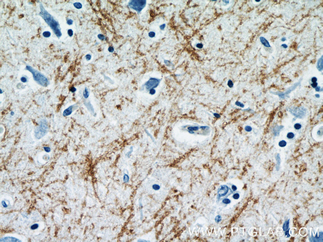 Myelin basic protein Antibody in Immunohistochemistry (Paraffin) (IHC (P))