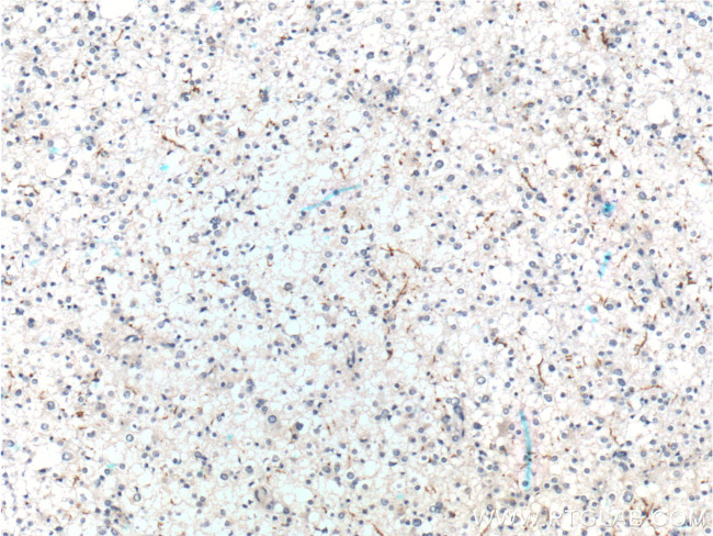 Myelin basic protein Antibody in Immunohistochemistry (Paraffin) (IHC (P))