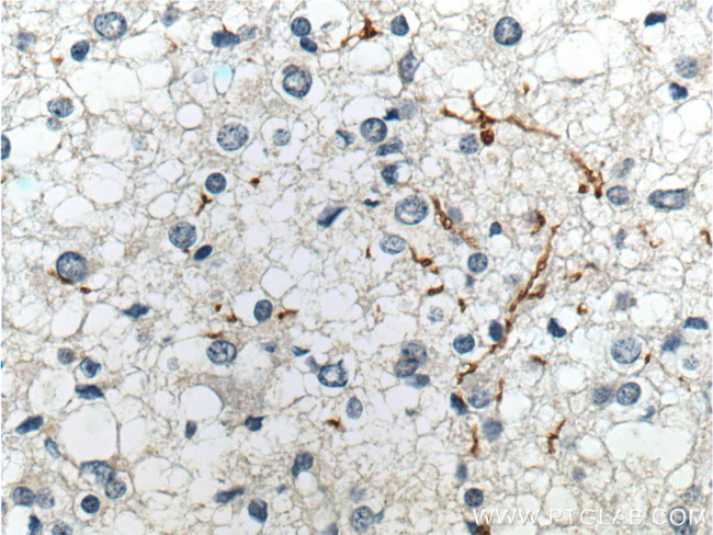 Myelin basic protein Antibody in Immunohistochemistry (Paraffin) (IHC (P))