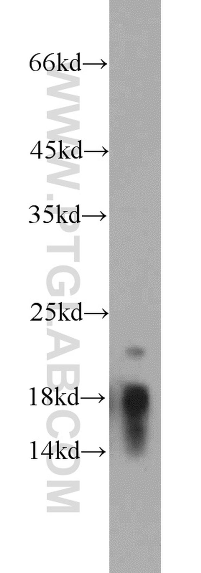 Myelin basic protein Antibody in Western Blot (WB)