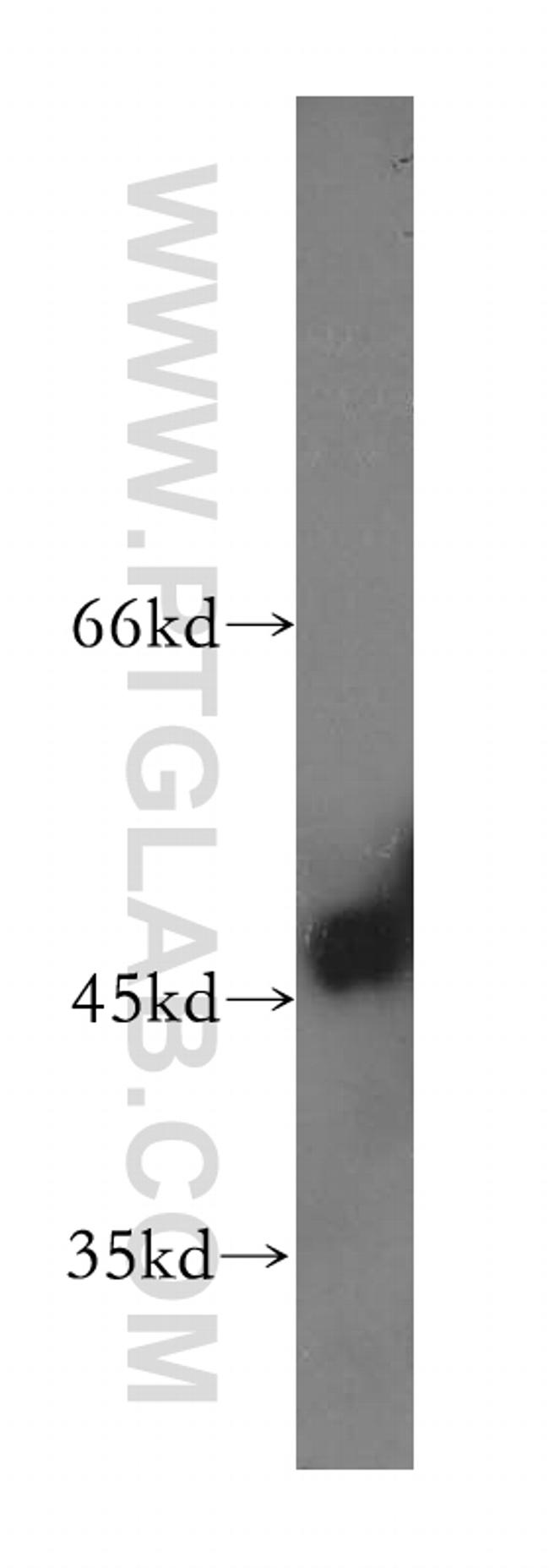 EIF4A3 Antibody in Western Blot (WB)