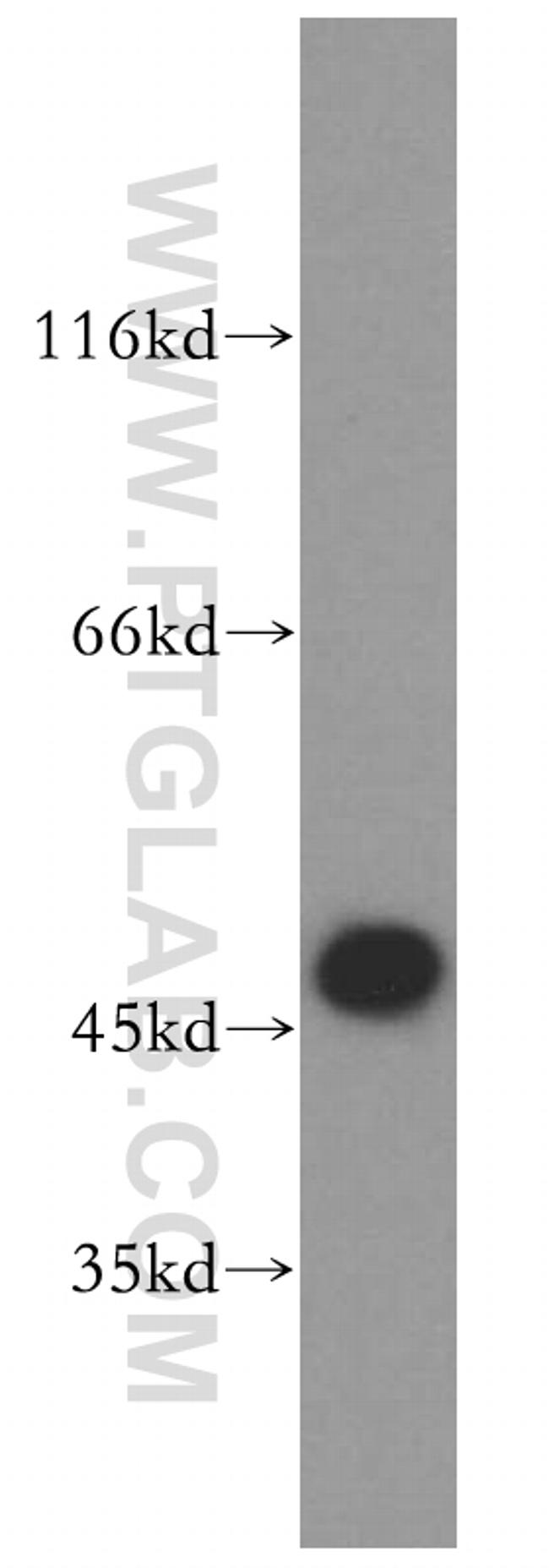 EIF4A3 Antibody in Western Blot (WB)