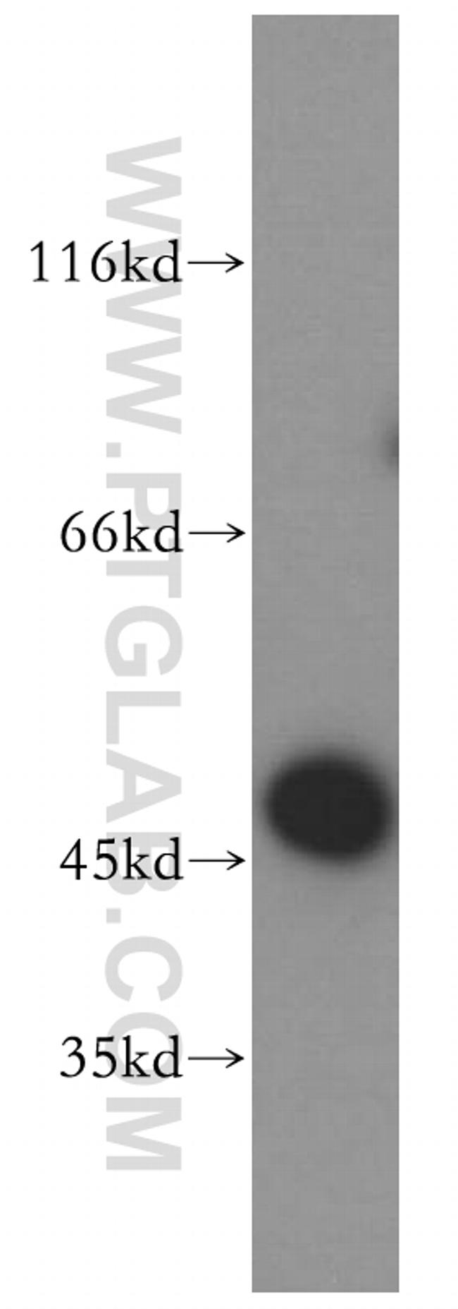 EIF4A3 Antibody in Western Blot (WB)