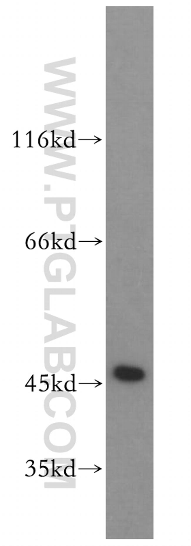 EIF4A3 Antibody in Western Blot (WB)