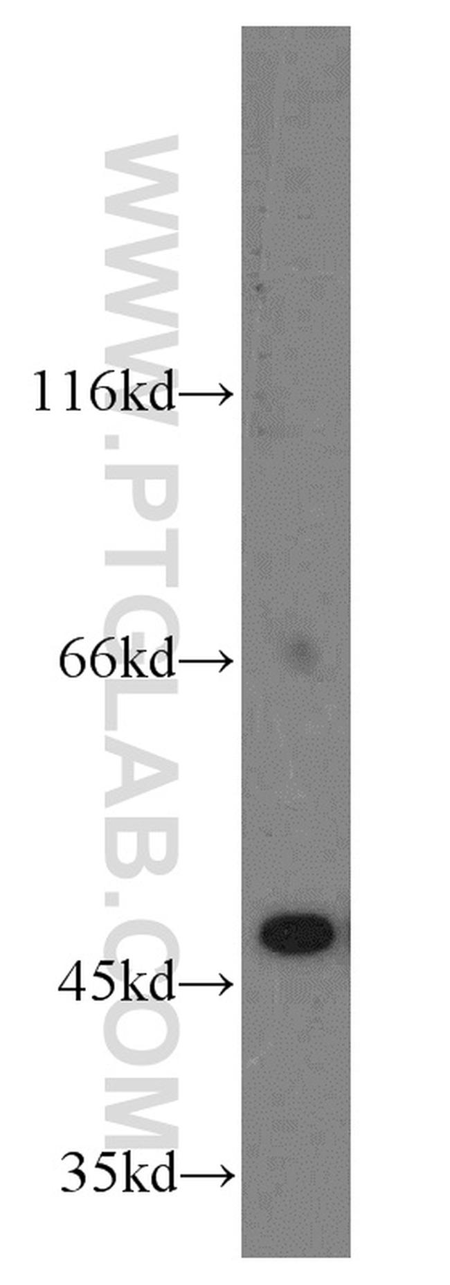 EIF4A3 Antibody in Western Blot (WB)