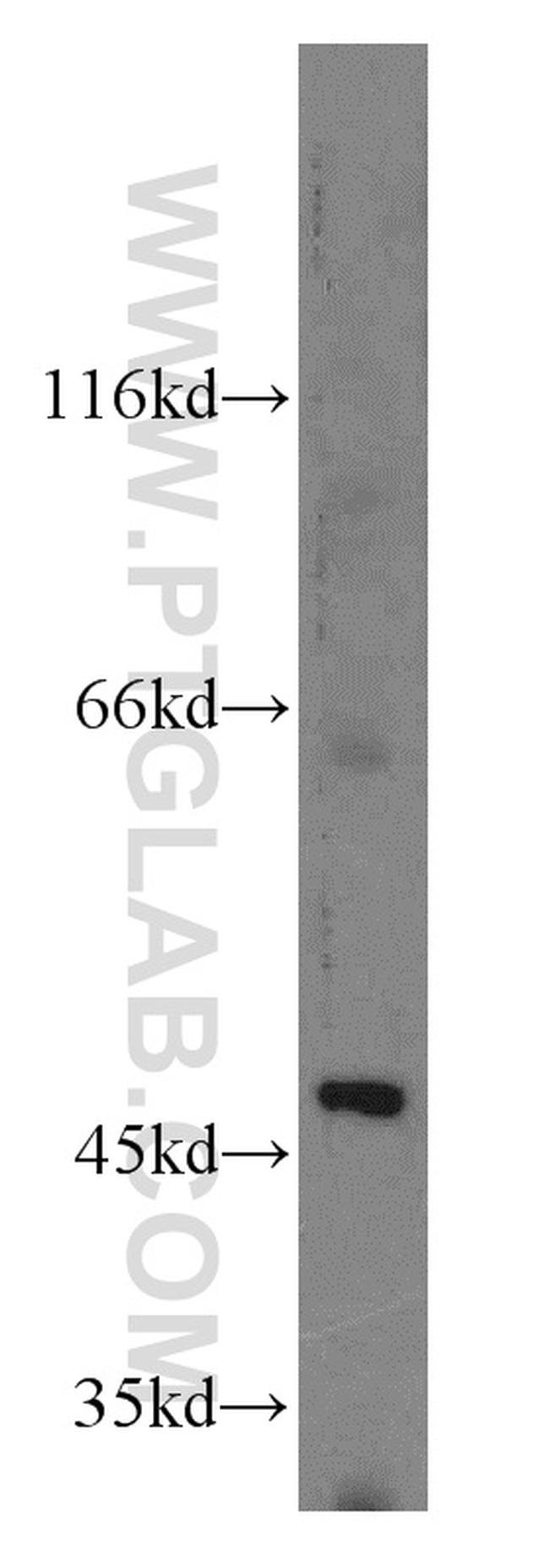 EIF4A3 Antibody in Western Blot (WB)