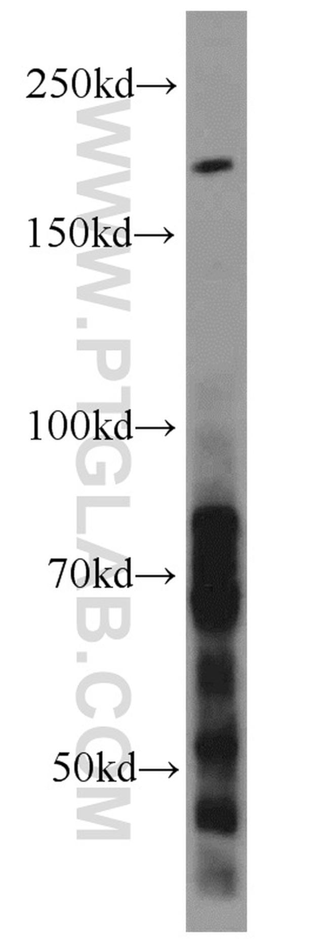 LAMA4 (Isoform 3) Antibody in Western Blot (WB)