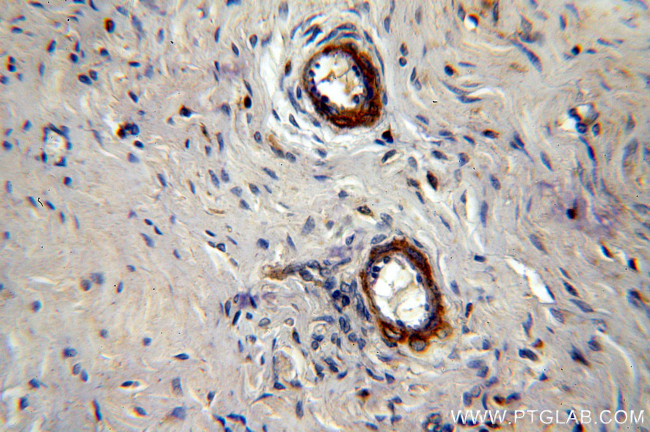 LAMA4 (Isoform 3) Antibody in Immunohistochemistry (Paraffin) (IHC (P))