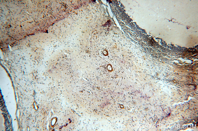 LAMA4 (Isoform 3) Antibody in Immunohistochemistry (Paraffin) (IHC (P))