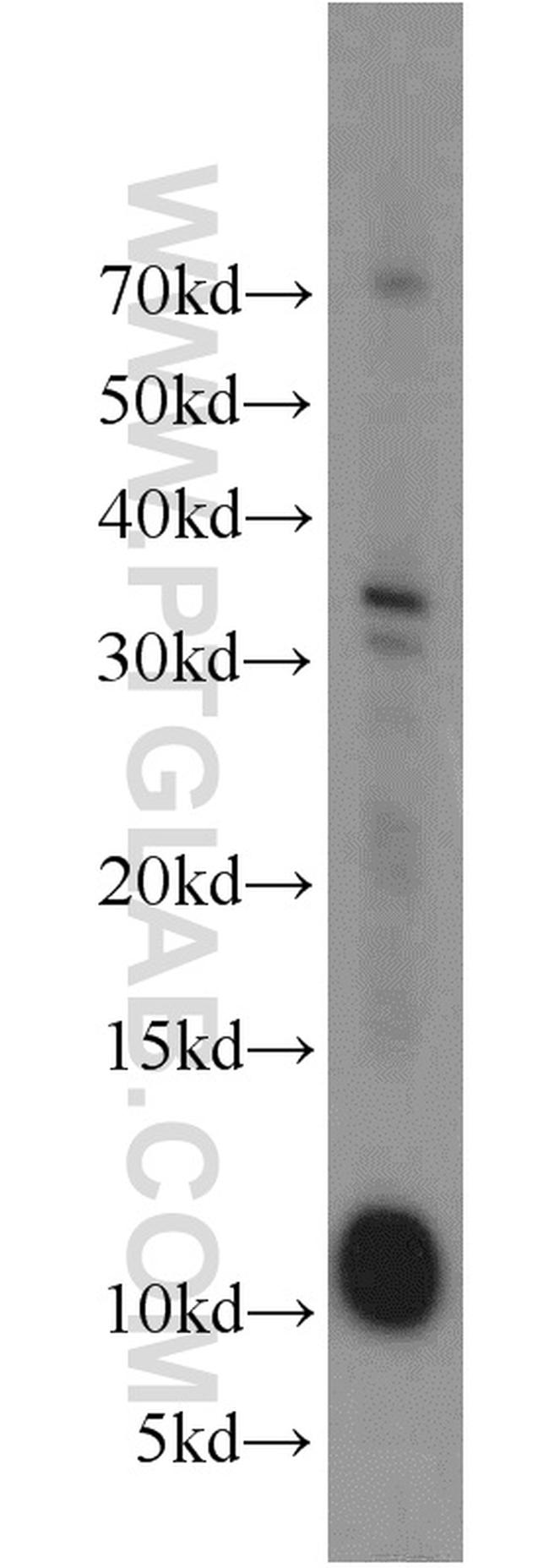 LAMA4 (Isoform 3) Antibody in Western Blot (WB)