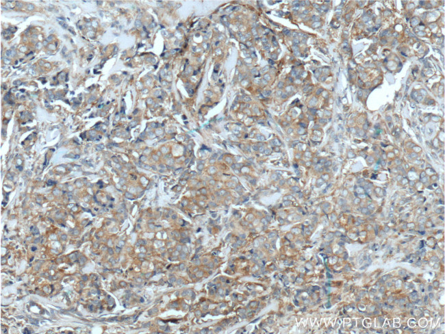 CXCL14 Antibody in Immunohistochemistry (Paraffin) (IHC (P))