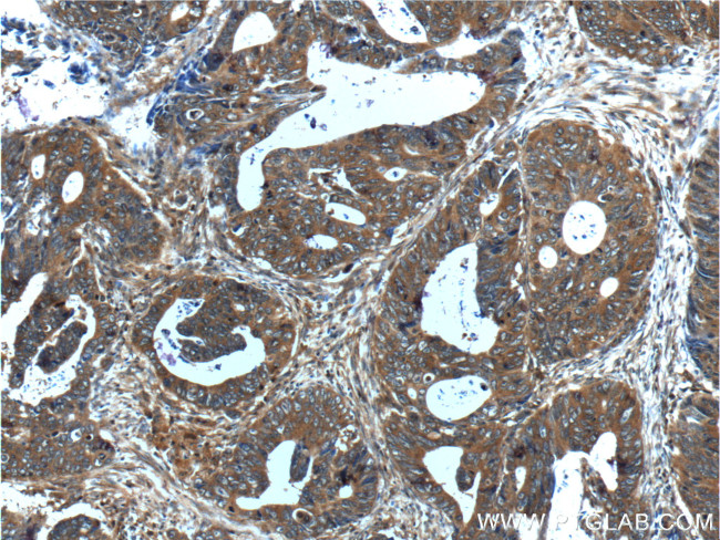 CXCL14 Antibody in Immunohistochemistry (Paraffin) (IHC (P))