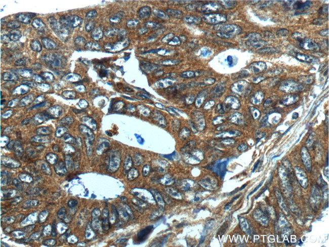 CXCL14 Antibody in Immunohistochemistry (Paraffin) (IHC (P))