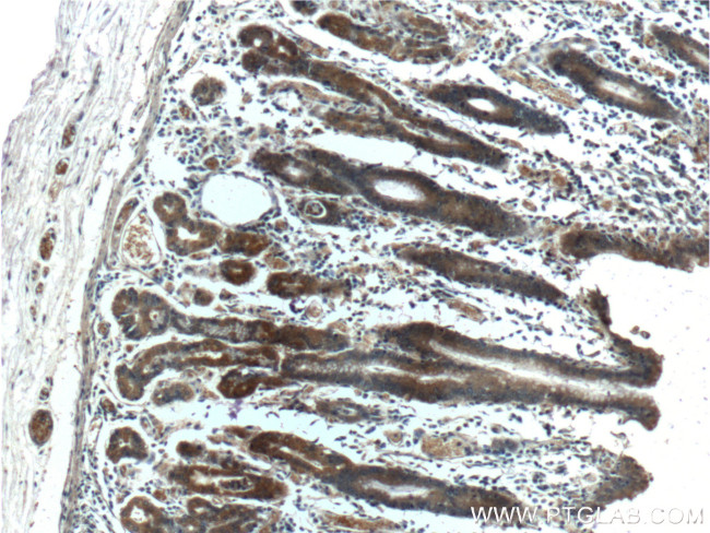 CXCL14 Antibody in Immunohistochemistry (Paraffin) (IHC (P))