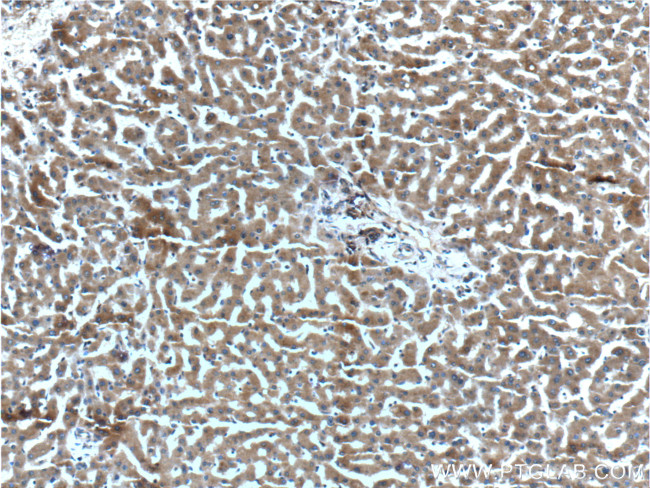 CXCL14 Antibody in Immunohistochemistry (Paraffin) (IHC (P))