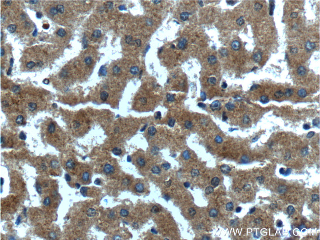 CXCL14 Antibody in Immunohistochemistry (Paraffin) (IHC (P))