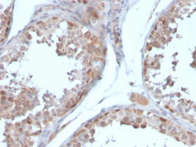 Follistatin/Activin Binding Protein Antibody in Immunohistochemistry (Paraffin) (IHC (P))